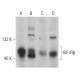 IGF-1 Receptor β/IGF1R Antibody (D-11) - Western Blotting - Image 360987