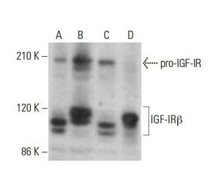 western blotting image from recommended IGF-1 Receptor &beta;/IGF1R (F-1) monoclonal antibody replacement. Image 352078