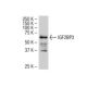 IGF2BP3 Antibody (DE-7) - Western Blotting - Image 34139 