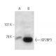 IGF2BP3 Antibody (DE-7) - Western Blotting - Image 38408
