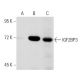 IGF2BP3 Antibody (DE-7) - Western Blotting - Image 52909 