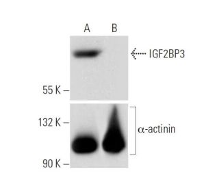 IGF2BP3 HDR Plasmid (h): sc-402603-HDR. Western blot analysis of IGF2BP3 expression in non-transfected control (A) and pur 