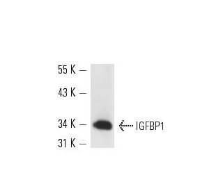 western blotting image from recommended IGFBP1 (H-5) monoclonal antibody replacement. Image 13580