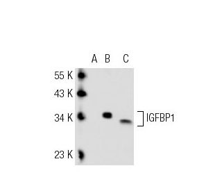 IGFBP1 Antibody (H-5) - Western Blotting - Image 43203Each CRISPR/Cas9 Knockout (KO) Plasmid product consists of a pool of 3 plasmids designed to ensure identification and cleavage of a specific gene for maximum knockout efficiency. Each plasmid encodes a unique 20 nt sequence derived from the GeCKO (v2) library.