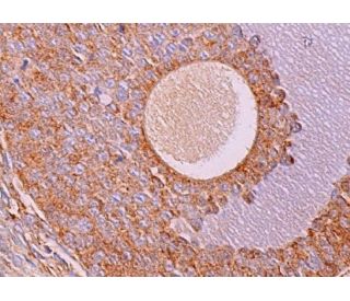 IGFBP2 Antibody (G-4) - Immunohistochemistry - Image 370198 
