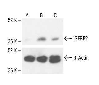 IGFBP2 Antibody (1F6F6) - Western Blotting - Image 411974