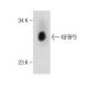 This polyclonal antibody has been discontinued. See our recommended <a href="igfbp3-antibody-e-9">IGFBP3 (E-9)</a> monoclonal antibody (sample data shown). western blotting image from recommended IGFBP3 (E-9) monoclonal antibody replacement. Image 283568