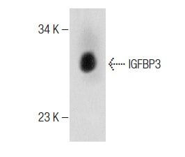 IGFBP3 Antibody (H-98) | SCBT - Santa Cruz Biotechnology