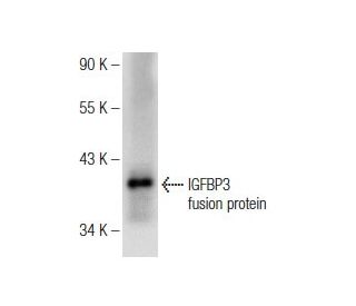 IGFBP3 Antibody (B-5) - Western Blotting - Image 146381The Double Nickase Plasmid features a U6 promoter for sgRNA expression, a 20 nt targeting sequence, and a gRNA scaffold to guide Cas9n. It includes a CBh promoter for Cas9n (D10A) and puromycin resistance, GFP for transfection verification, and nuclear localization signals (NLS). The 2A peptide allows co-expression of Cas9n and Puro from a single promoter, enabling precise genome editing with reduced off-target effects.