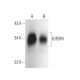 western blotting image from recommended IGFBP4 (A3) monoclonal antibody replacement. Image 374577