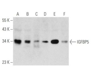 western blotting image from recommended IGFBP5 (D-6) monoclonal antibody replacement. Image 356542