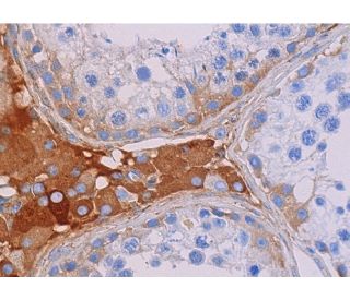 immunohistochemistry image from recommended IGFBP7 (H-3) monoclonal antibody replacement. Image 371445