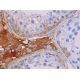 immunohistochemistry image from recommended IGFBP7 (H-3) monoclonal antibody replacement. Image 371445