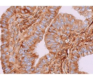 IGFBP7 Antibody (H-3) - Immunohistochemistry - Image 371446 