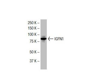 IGFN1 Antibody (S-2) - Western Blotting - Image 33502 