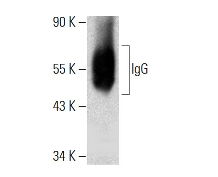 Igg Antibody Photos and Images & Pictures