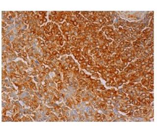 IgM Antibody (A-7) - Immunohistochemistry - Image 350225 