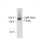 IgM Antibody (M11) - Western Blotting - Image 108983