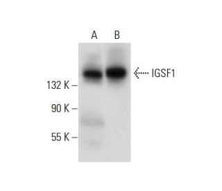 IGSF1 Antibody (F-7) - Western Blotting - Image 297983 