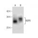 IGSF6 Antibody (H-5) - Western Blotting - Image 281241 