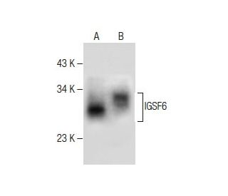 IGSF6 Antibody (H-5) - Western Blotting - Image 281241SAM Transcription Activation: SAM system utilizing dCas9-VP64, MS2-P65-HSF1, and sgRNA for precise gene transcription activation.