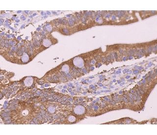 immunohistochemistry image from recommended Ihh (H-12) monoclonal antibody replacement. Image 372198