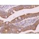 immunohistochemistry image from recommended Ihh (H-12) monoclonal antibody replacement. Image 372198