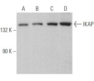 western blotting image from recommended IKAP (H-11) monoclonal antibody replacement. Image 362848