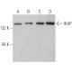 western blotting image from recommended IKAP (H-11) monoclonal antibody replacement. Image 362848