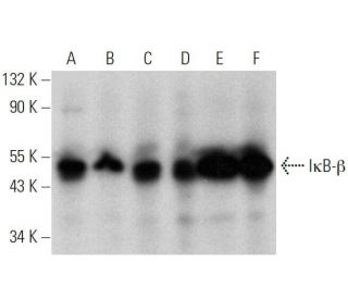 I&kappa;B-&beta; Antibody (D-3) - Western Blotting - Image 358543 