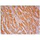 IκB-β Antibody (F-9) - Immunohistochemistry - Image 302381