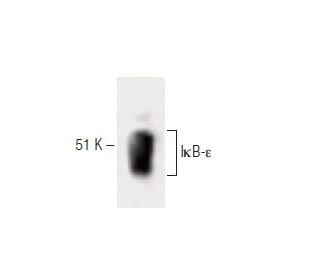 I&kappa;B-&epsilon; Antibody (21) - Western Blotting - Image 60323 
