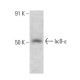 IκB-ε Antibody (D-7) - Western Blotting - Image 358587 