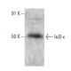 IκB-ε Antibody (E-9) - Western Blotting - Image 358588 