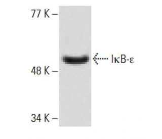 western blotting image from recommended I&kappa;B-&epsilon; (G-4) monoclonal antibody replacement. Image 1071