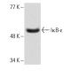 western blotting image from recommended IκB-ε (G-4) monoclonal antibody replacement. Image 1071