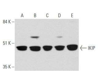 IKIP Antibody (E-3) - Western Blotting - Image 345954 