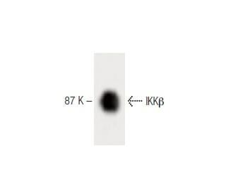 IKKβ Antibody (24) - Western Blotting - Image 60326