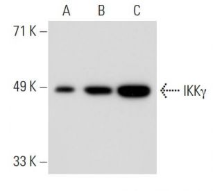 IKKγ Antibody (72C627) - Western Blotting - Image 36840