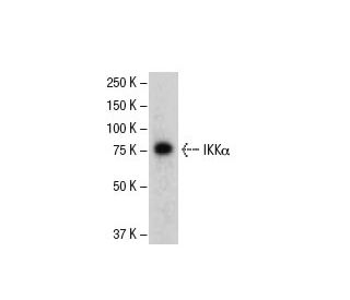 IKK alpha Antibody (61AT277) - Western Blotting - Image 37653