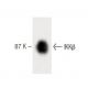 IKKβ Antibody (24) - Western Blotting - Image 60326 