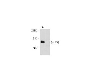 western blotting image from recommended IKK&beta; (H-4) monoclonal antibody replacement. Image 2055