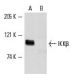 western blotting image from recommended IKKβ (H-4) monoclonal antibody replacement. Image 2055