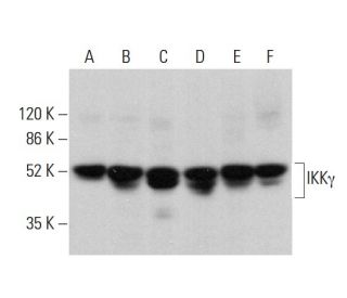 western blotting image from recommended IKK&gamma; (F-10) monoclonal antibody replacement. Image 379864