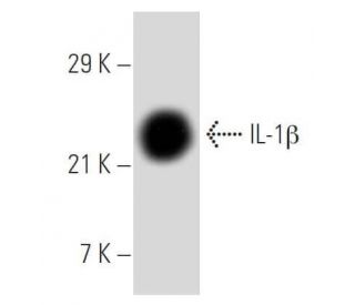 IL-1 beta/IL1B Antibody (E7-2-hIL1β) - Western Blotting - Image 8894