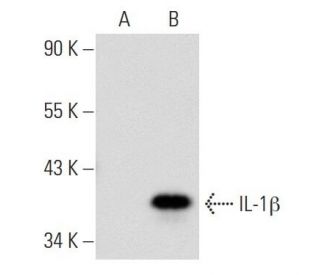 IL-1 beta/IL1B Antibody (E7-2-hIL1β) - Western Blotting - Image 56608