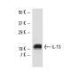 IL-10 Antibody (3C12C12) - Western Blotting - Image 11048
