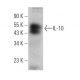 IL-10 Antibody (E-10) - Western Blotting - Image 361616