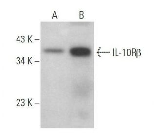 IL-10Rβ Antibody (B-4) - Western Blotting - Image 359150