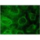 Este anticorpo policlonal foi descontinuado. Consulta o nosso anticorpo monoclonal <a href="il-10ralpha-antibody-a-3">IL-10Rα (A-3)</a> recomendado (dados de amostra apresentados). immunofluorescence image from recommended IL-10Rα (A-3) monoclonal antibody replacement. Image 145107